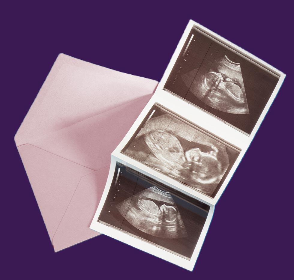 ultrasound-photo2 Ultrasound photo